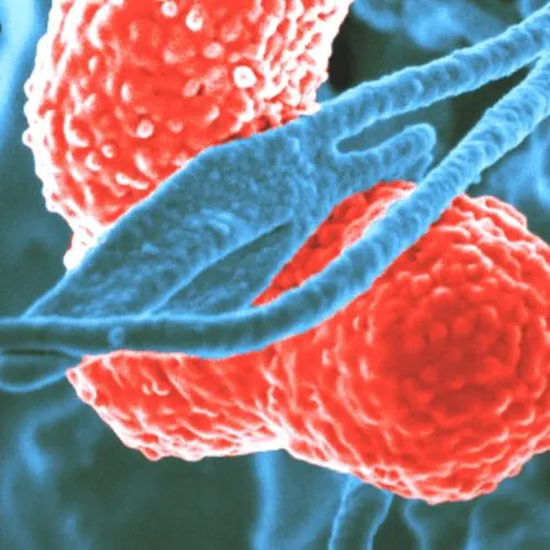 Sepsis-Infection-Signs-Treatment What is Sepsis – Medical Background and Warning Signs