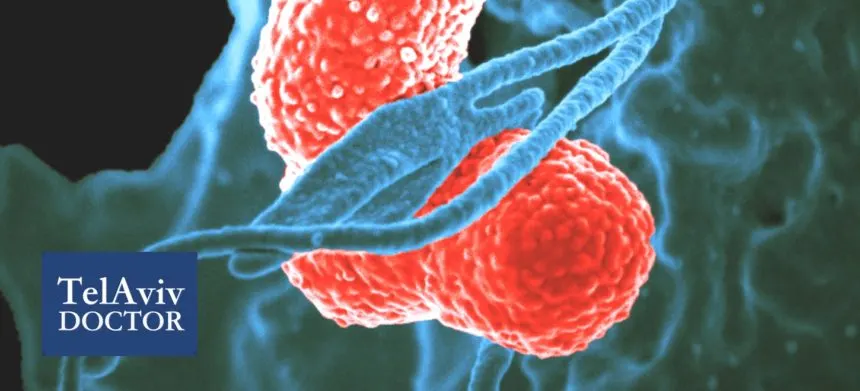 Sepsis-Infection-Signs-Treatment | Tel Aviv Doctor What is Sepsis – Medical Background and Warning Signs